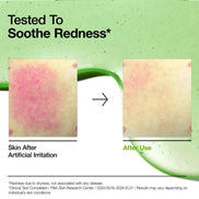 ANUA AZELAIC ACID 10+HYALURON REDNESS SOOTHING SERUM  30ML